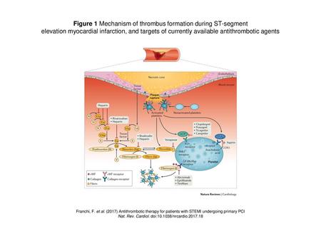 Figure 1 Mechanism of thrombus formation during ST-segment