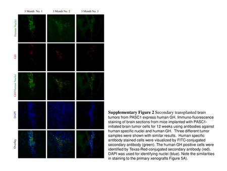 Supplementary Figure 2 Secondary transplanted brain tumors from PASC1 express human GH. Immuno-fluorescence staining of brain sections from mice implanted.