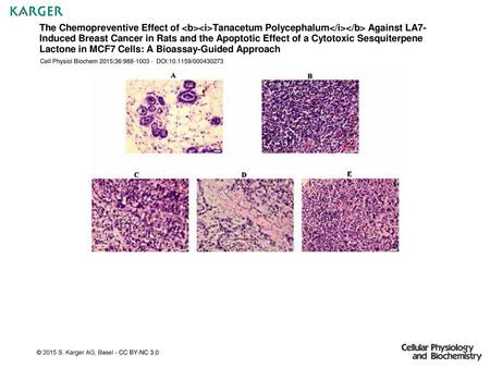 The Chemopreventive Effect of Tanacetum Polycephalum Against LA7-Induced Breast Cancer in Rats and the Apoptotic Effect of a Cytotoxic Sesquiterpene.