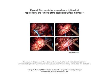 Figure 2 Representative images from a right radical