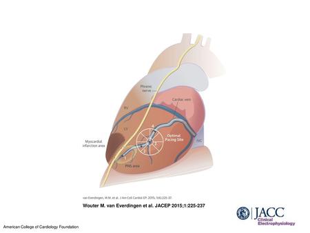 Wouter M. van Everdingen et al. JACEP 2015;1: