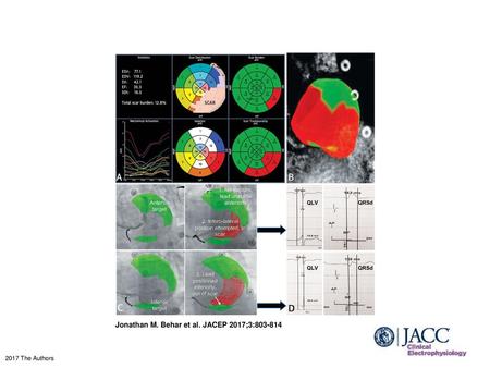 Jonathan M. Behar et al. JACEP 2017;3: