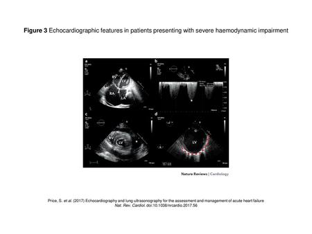 Nat. Rev. Cardiol. doi: /nrcardio