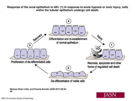 Response of the renal epithelium to AKI