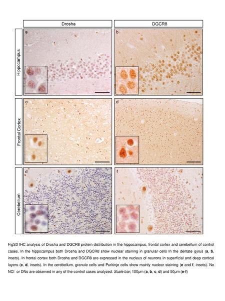 FigS3 IHC analysis of Drosha and DGCR8 protein distribution in the hippocampus, frontal cortex and cerebellum of control cases. In the hippocampus both.