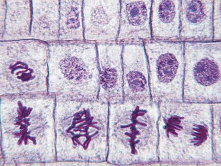 RNA processing and transport RNA degradation Translation