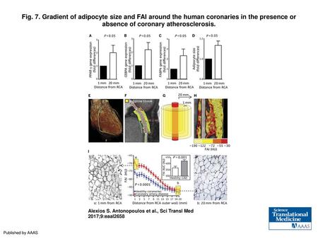 Fig. 7. Gradient of adipocyte size and FAI around the human coronaries in the presence or absence of coronary atherosclerosis. Gradient of adipocyte size.