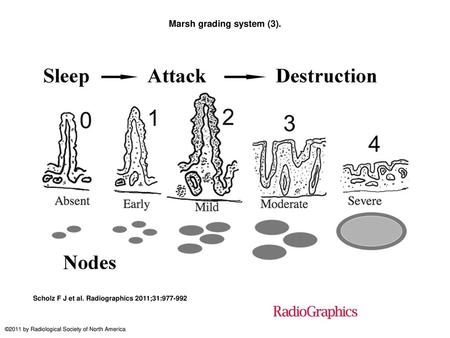 Marsh grading system (3).