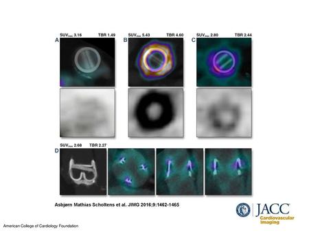 Asbjørn Mathias Scholtens et al. JIMG 2016;9: