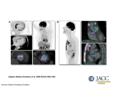 Asbjørn Mathias Scholtens et al. JIMG 2016;9: