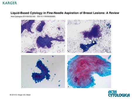 Acta Cytologica 2014;58: DOI: /