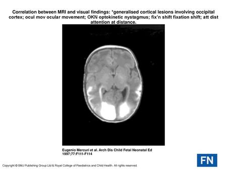 Correlation between MRI and visual findings: