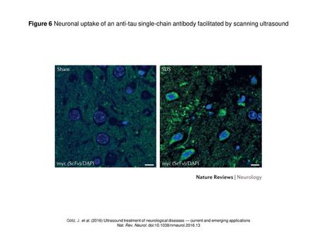 Nat. Rev. Neurol. doi: /nrneurol