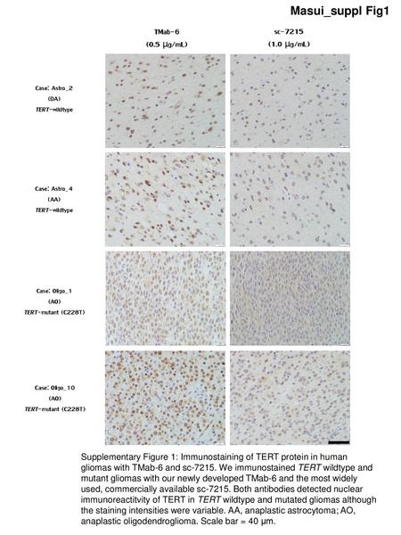 Masui_suppl Fig1 TMab-6 sc-7215 (0.5 μg/mL) (1.0 μg/mL) Case: Astro_2