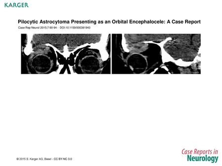 Case Rep Neurol 2015;7: DOI: /