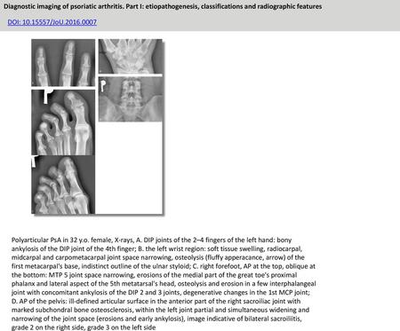 Diagnostic imaging of psoriatic arthritis