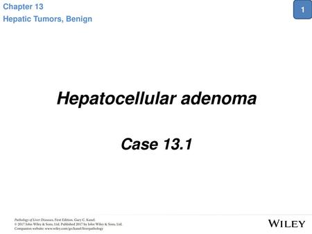 Hepatocellular adenoma