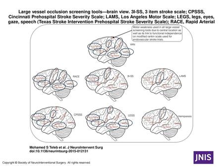 Large vessel occlusion screening tools—brain view