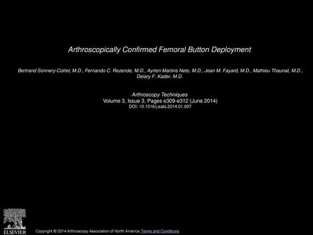 Arthroscopically Confirmed Femoral Button Deployment