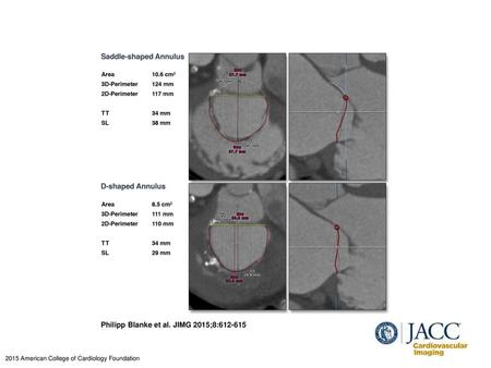 Philipp Blanke et al. JIMG 2015;8: