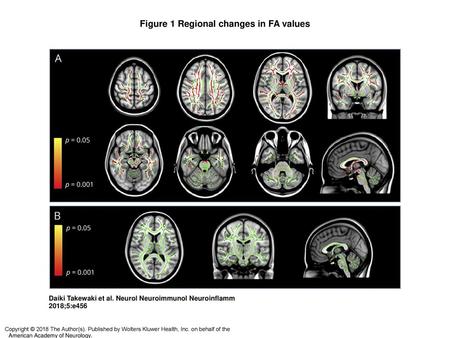 Figure 1 Regional changes in FA values