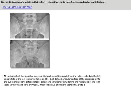 Diagnostic imaging of psoriatic arthritis