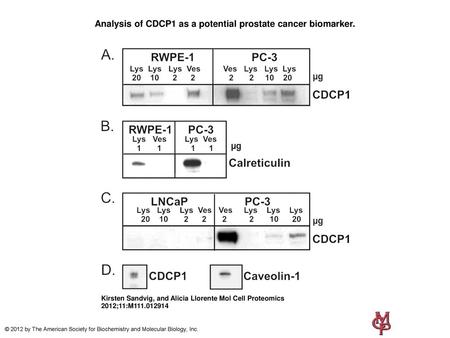 Analysis of CDCP1 as a potential prostate cancer biomarker.