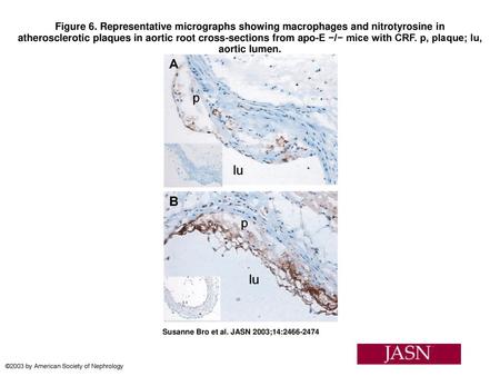 Figure 6. Representative micrographs showing macrophages and nitrotyrosine in atherosclerotic plaques in aortic root cross-sections from apo-E −/− mice.