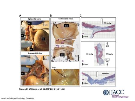 Steven E. Williams et al. JACEP 2015;1: