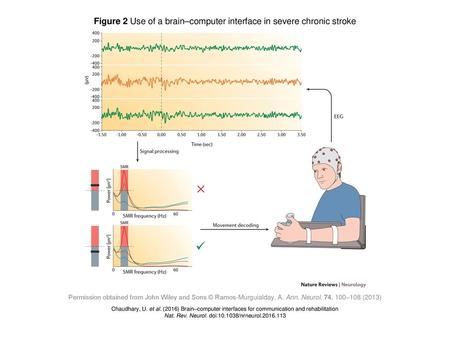 Figure 2 Use of a brain–computer interface in severe chronic stroke