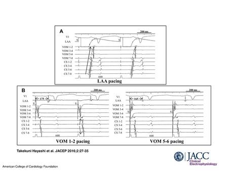 Takekuni Hayashi et al. JACEP 2016;2:27-35