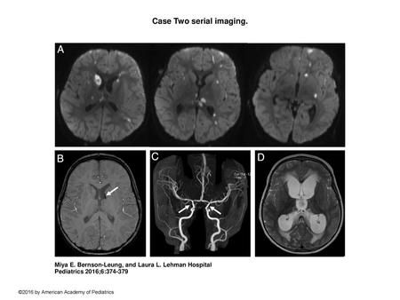 Case Two serial imaging.