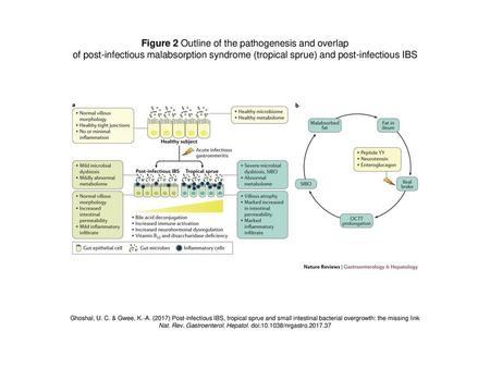 Figure 2 Outline of the pathogenesis and overlap