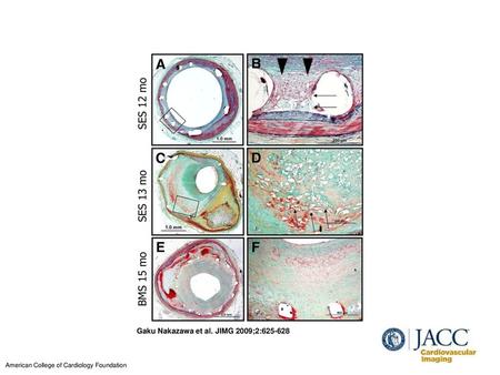 Gaku Nakazawa et al. JIMG 2009;2: