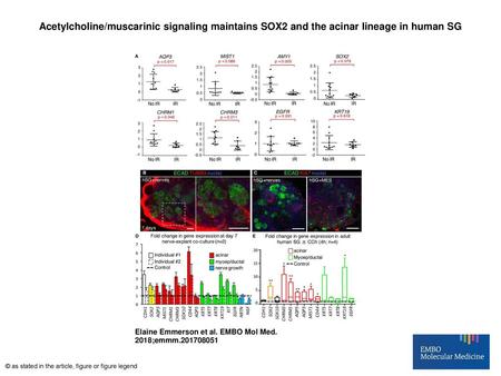 Acetylcholine/muscarinic signaling maintains SOX2 and the acinar lineage in human SG Acetylcholine/muscarinic signaling maintains SOX2 and the acinar lineage.