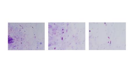 Figure 1: Location of the neurons in the aortic root GP.