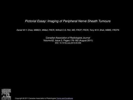 Pictorial Essay: Imaging of Peripheral Nerve Sheath Tumours