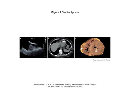 Nat. Rev. Cardiol. doi: /nrcardio