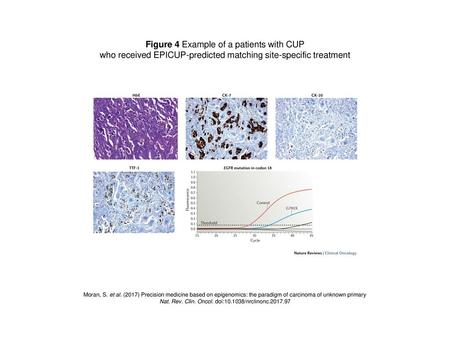 Figure 4 Example of a patients with CUP