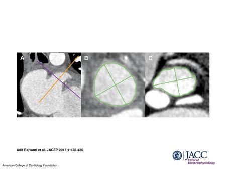 Adil Rajwani et al. JACEP 2015;1: