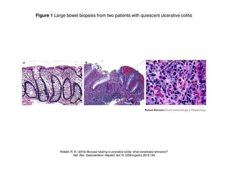 Nat. Rev. Gastroenterol. Hepatol. doi: /nrgastro