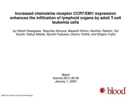 Increased chemokine receptor CCR7/EBI1 expression enhances the infiltration of lymphoid organs by adult T-cell leukemia cells by Hitoshi Hasegawa, Tetsuhiko.