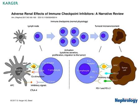 Adverse Renal Effects of Immune Checkpoint Inhibitors: A Narrative Review Am J Nephrol 2017;45:160-169 - DOI:10.1159/000455014 Fig. 1. CTLA-4 and PD-1.