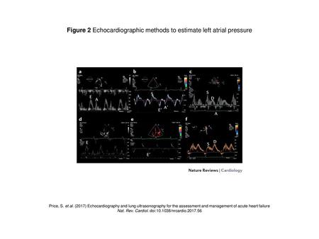 Figure 2 Echocardiographic methods to estimate left atrial pressure