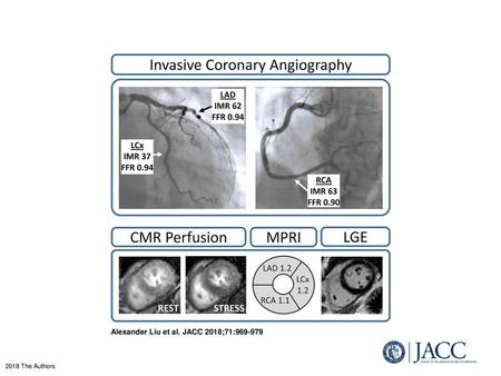 Alexander Liu et al. JACC 2018;71: