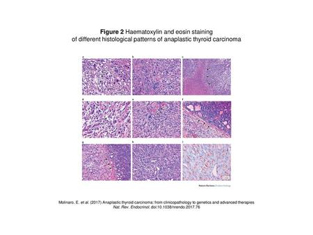 Figure 2 Haematoxylin and eosin staining