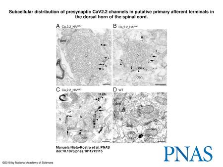 Subcellular distribution of presynaptic CaV2