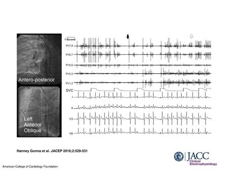 Hanney Gonna et al. JACEP 2016;2: