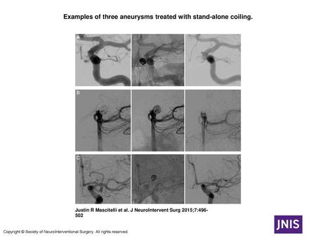 Examples of three aneurysms treated with stand-alone coiling.