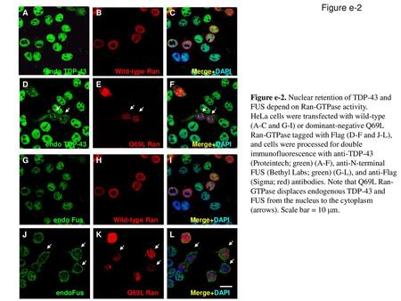 Figure e-2 A B C endo TDP-43 Wild-type Ran Merge+DAPI D E F